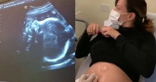L'ecografia di Silvia Provvedi è social