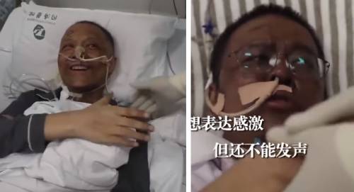 Cos'è accaduto ai medici svegliatisi con la pelle scura: le ipotesi