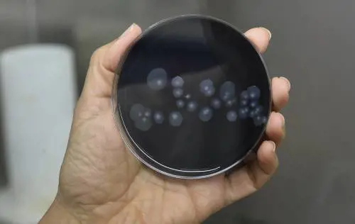 Ad Aviano è allerta legionella. Il sindaco: "Non fate la doccia"