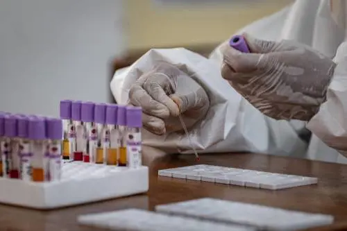 Coronavirus, test sierologici su larga scala: c'è l'okay del governo