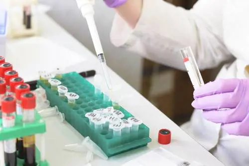 Anakinra, farmaco anti artrite contro i casi gravi di Covid-19
