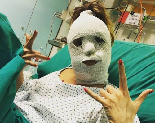 Foto choc di Gessica Notaro dopo l'attacco con l'acido: "Mi ha salvato la mia follia" 