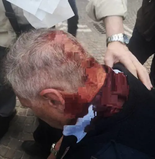 Il vigile rimprovera ragazzini in strada, loro gli spaccano la testa