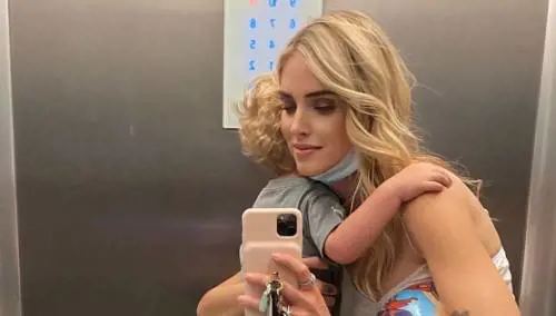 "Quante punturine fai? Il tuo viso è cambiato". L'ombra del botox su Chiara Ferragni