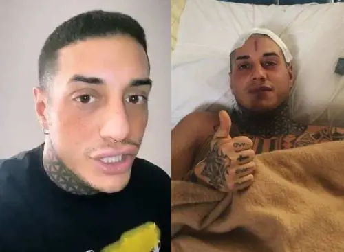 Francesco Chiofalo svela: "Prima di rimuovere il tumore ho pensato di farla finita"