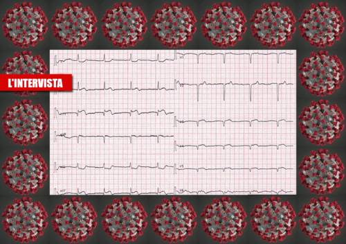 Elettrocardiogramma in paziente affetto da Covid-19