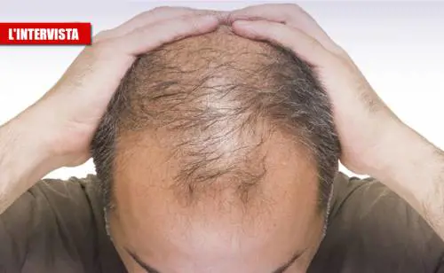 Il virus e il legame coi capelli: "Colpisce di più chi non li ha"