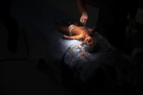 Il traffico di organi fa paura: le persone spariscono nel nulla