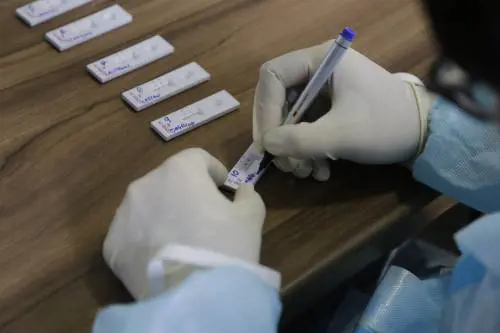 Il boomerang anticorpi. Chi ha avuto il Covid è esposto a rischi maggiori?