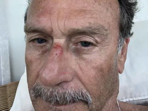 Cellino aggredito da due malviventi: ''Volevano derubarmi, li ho presi a calci...''
