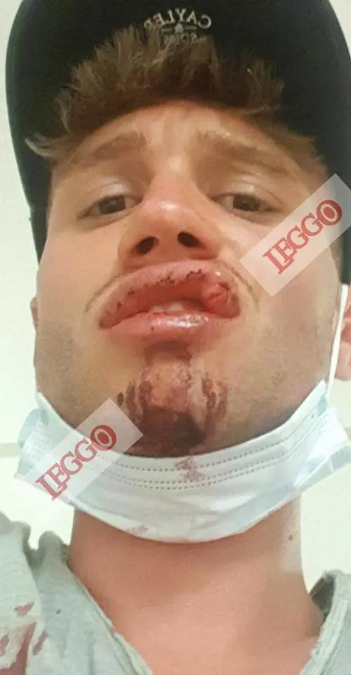 "Che ci guardi?", poi la rissa Pestaggio inguaia due agenti