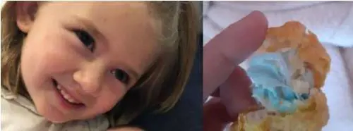 Una mascherina nel pollo: la bimba rischia di morire