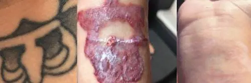 Schiaffo dei giudici all'agente: via per un vecchio tatuaggio