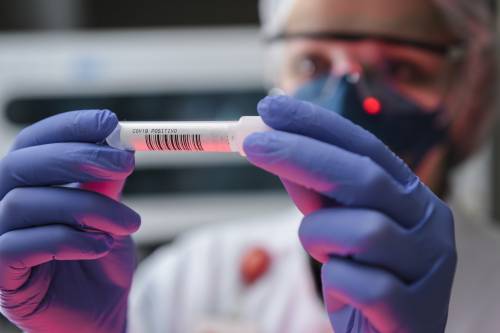 "Virus nato in un laboratorio". Ecco chi è la dottoressa cinese