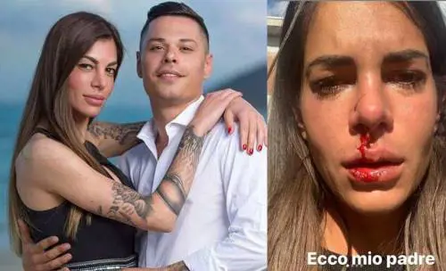 "Così mi ha ridotto mio padre": le foto choc dell’ex di Temptation Island