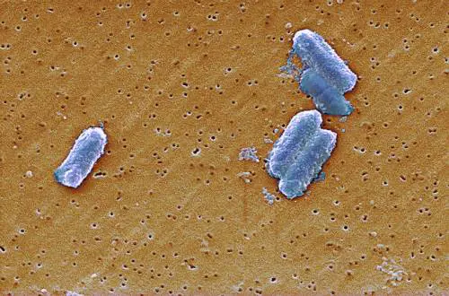 Citrobacter, come si manifesta il batterio che uccide un bimbo su tre
