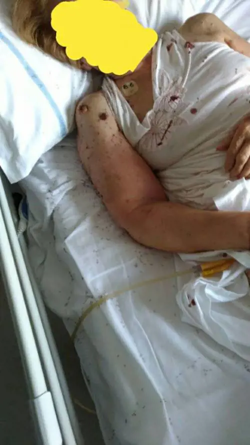 Napoli, le formiche in ospedale: 17 gli indagati