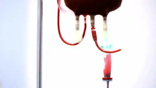 Trapianto di midollo osseo, cos'è e come avviene