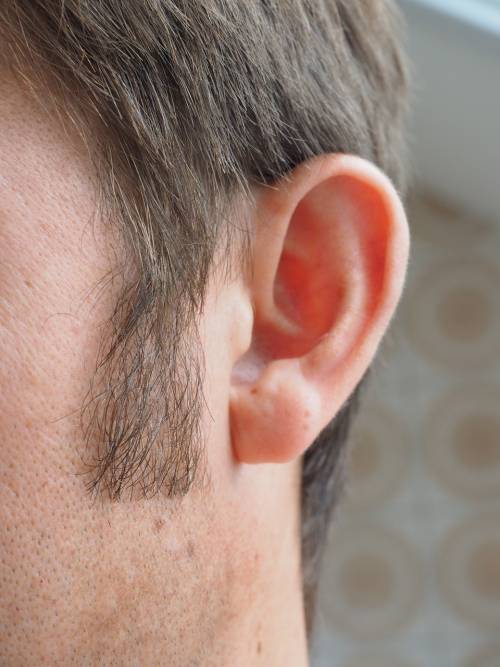 Covid, studio dimostra che può provocare perdita dell'udito
