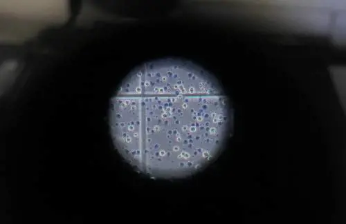 Qual è il "punto debole" dell'incubo Coronavirus