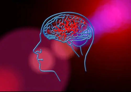 Ictus cerebrale, come prevenirlo