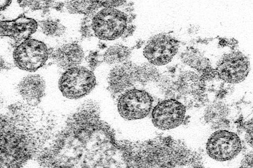 La pandemia che non esplose: cosa fermò l'incubo della Sars