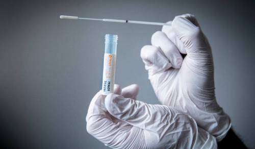 Cambiano i test per la definizione dei nuovi casi di coronavirus