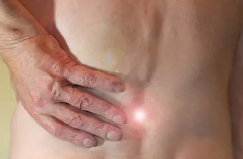 Sciatica: cause e come curarla con rimedi naturali veloci