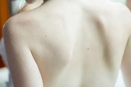 Melanoma, una speranza dai trapianti di microbiota fecale 