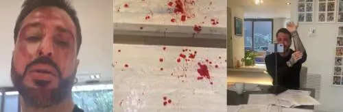 Corona deve tornare in carcere. Per protesta si taglia le vene: "Guardate gli atti o mi tolgo la vita"