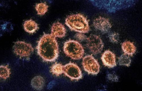 "Nuovi virus da temere": ecco dove si concentrano ora le Big Pharma