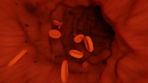 Contro il mieloma multiplo, una nuova terapia riaccende le speranze