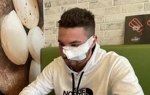 Il rider sfregiato: "Mi ha chiamato solo Salvini. La sinistra? In silenzio"