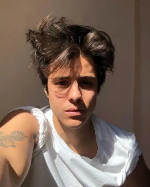 Michele non ce l'ha fatta: la giovane star di "Amici" uccisa da una leucemia