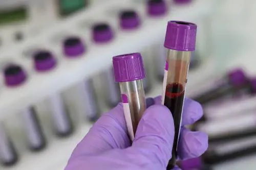 Covid, ecco perché il sangue dei vaccinati è sicuro