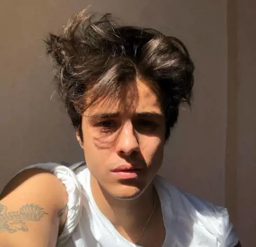 "Bastava un emocromo". Così Michele Merlo poteva essere salvato