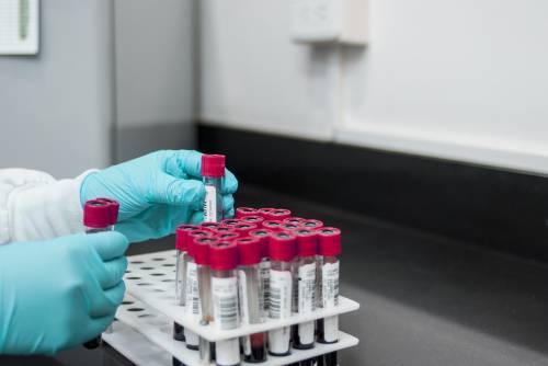 Nuovo test del sangue scopre 50 tipi di cancro
