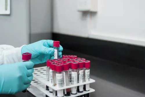 Luspatercept, la nuova molecola per combattere la beta-talassemia