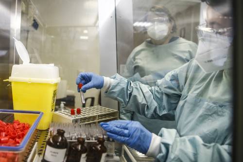 “Ecco quali sono i veri pericoli del virus Marburg”
