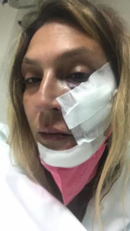 "Ho sentito rompersi i denti". Così Beatrice è stata aggredita