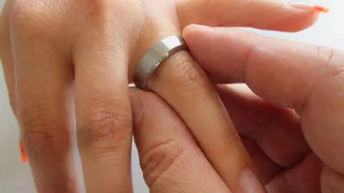Pakistan, si sposa per amore: il padre le dà fuoco