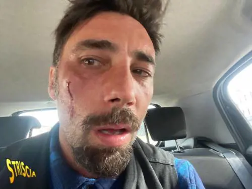 "Ha mostrato i genitali alla telecamera": arrestati gli aggressori di Brumotti