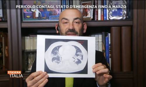 "Guardate le TAC dei no vax, sono devastanti": l'allarme di Bassetti in tv