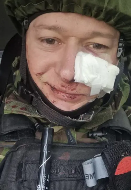 "Idioti, questi sono i nazisti che combattete". Il cantante ucraino ferito dai russi