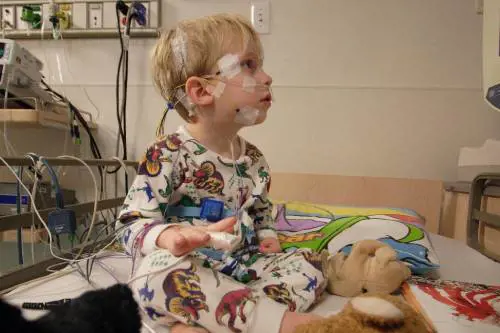 Paura per l'"epatite ignota" che colpisce i bimbi