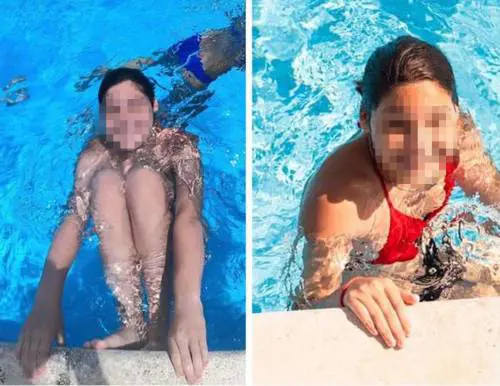 Morta dopo un panino "Allergica alla caseina"