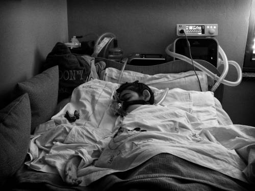 La malattia genetica rara, l'amore e le cure: storia della dolce Federica