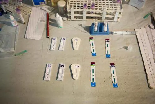 180 casi di epatite infantile sconosciuta: ecco cosa sta succedendo