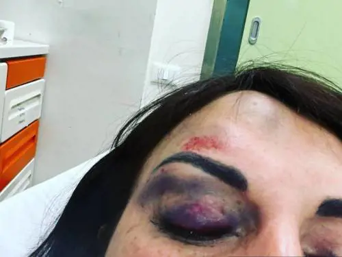 Divieto di avvicinamento per l'ex di Francesca De André dopo le aggressioni