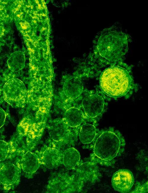 Il bello delle lotte intestine